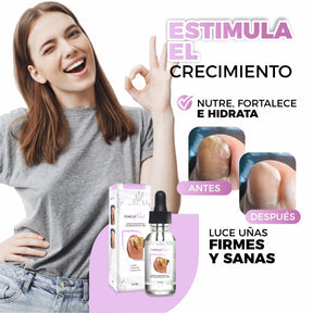 2 Unidades - Serum AntiHongos y Regenerador De Uñas - FungusNail®