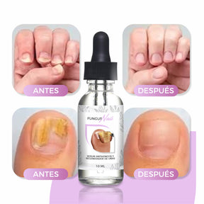 2 Unidades - Serum AntiHongos y Regenerador De Uñas - FungusNail®